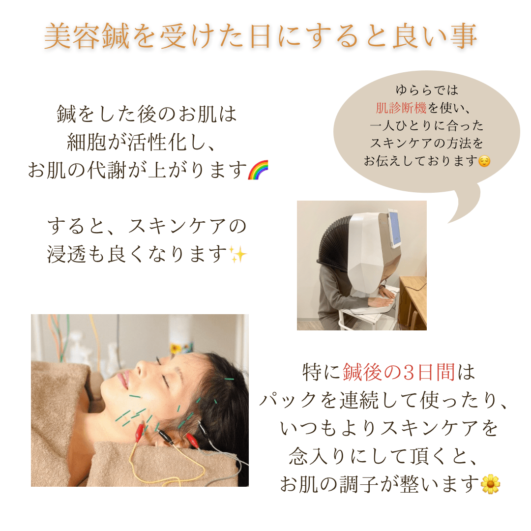 🌼美容鍼を受けた後日にすると良い事・しない方が良い事🌼